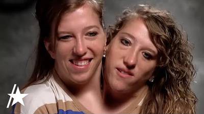 WATCH: Conjoined Twin Abby Hensel Of ‘Abby & Brittany’ Gets Married